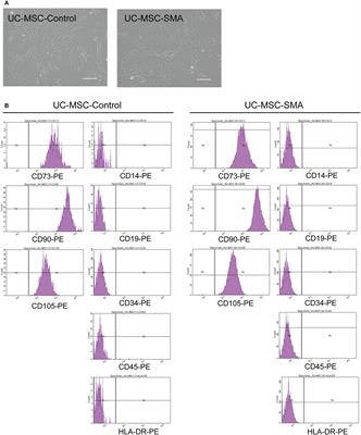 Gestational Age-Dependent Increase of Survival Motor Neuron Protein in Umbilical Cord-Derived Mesenchymal Stem Cells